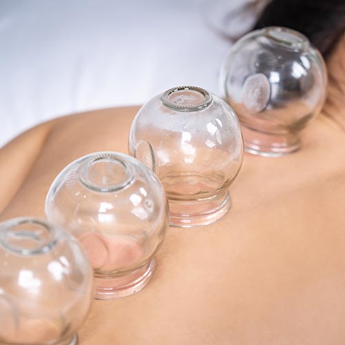 ACAOM-healthcare-Cupping-Wellness