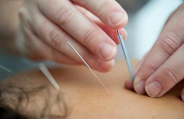 You are currently viewing Acupuncture to Regulate Menstrual Period and Alleviate Painful Menstruation and PMS